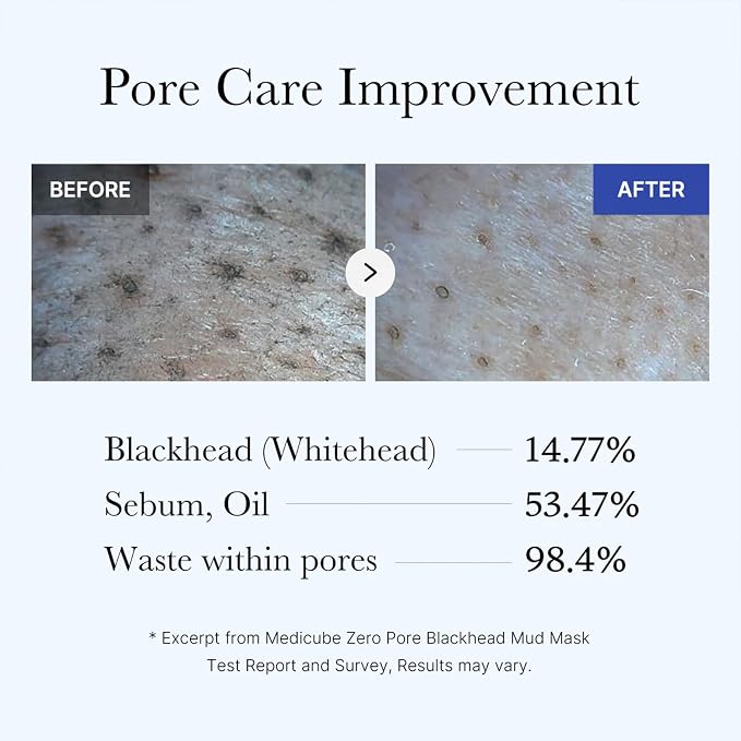 Medicube Zero Pore Blackhead Mud Facial Mask - Image 5