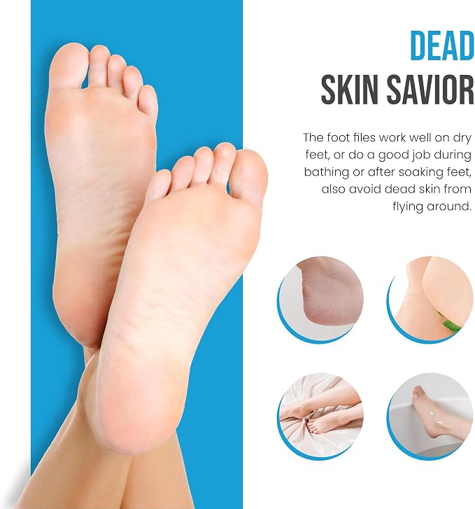 Foot Rasp Foot File Callus Remover Professional 7” Corn Removers - Image 5