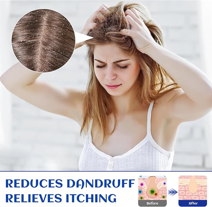 HIQILI Rosemary Oil for Hair Growth, 100% Pure Natural, Add to Shampoo & - Image 4