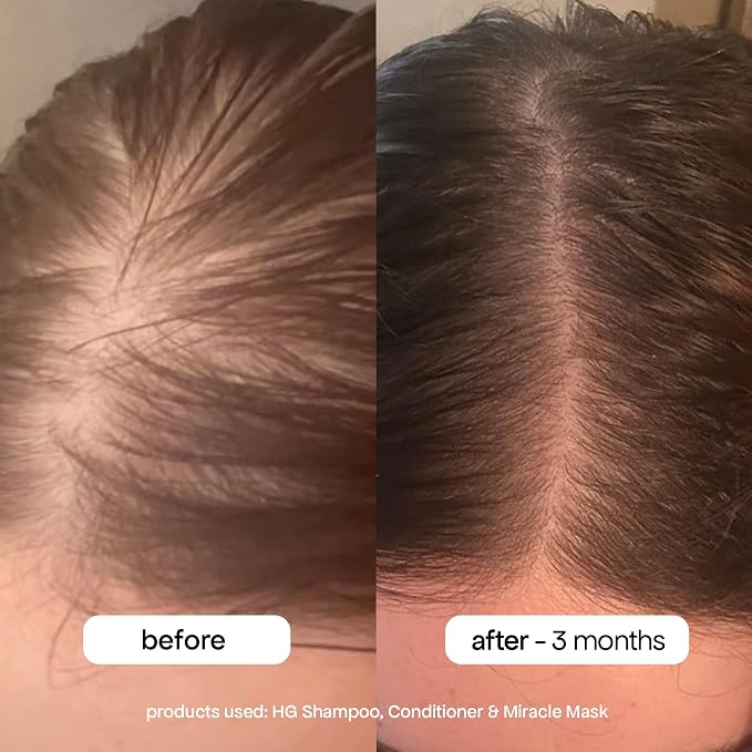 BONDIBOOST Miracle Hair Mask for Damaged Hair, Deep Conditioning Hair Mask for - Image 5