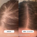 BONDIBOOST Miracle Hair Mask for Damaged Hair, Deep Conditioning Hair Mask for - Image 5