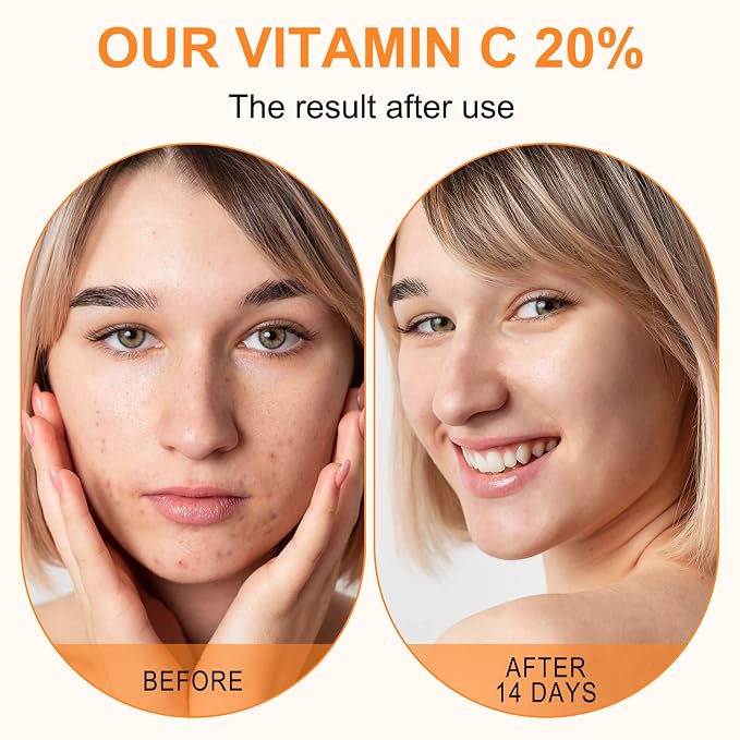 Premium 20% Vitamin C Serum For Face - Image 5