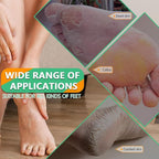 Professional Pedicure File and Callus Remover - Image 4