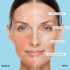 MAREE Glycolic Acid Polishes 2 PACK - Image 5