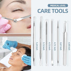 JPNK Blackhead Remover Comedone Extractor Acne Removal Kit.. - Image 7