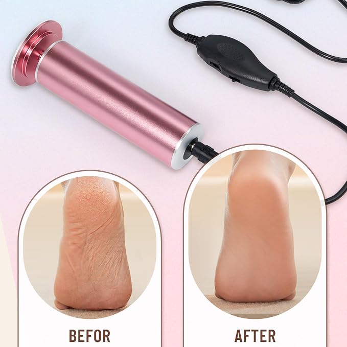 Dermawave Electric Foot File Callus Remover - Image 6