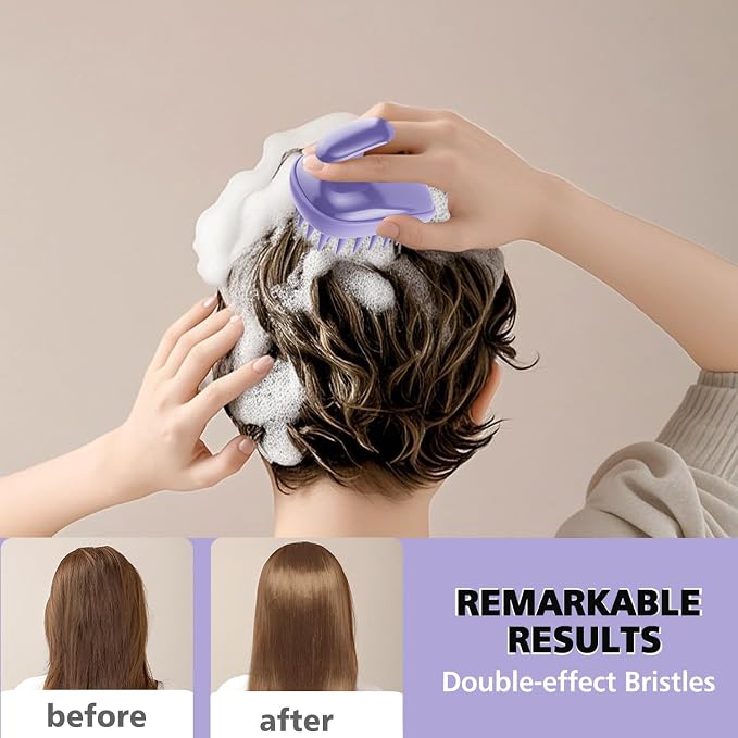2-in-1 Scalp Massager Shampoo Brush, Scalp Scrubber, Exfoliator Brush - Image 6