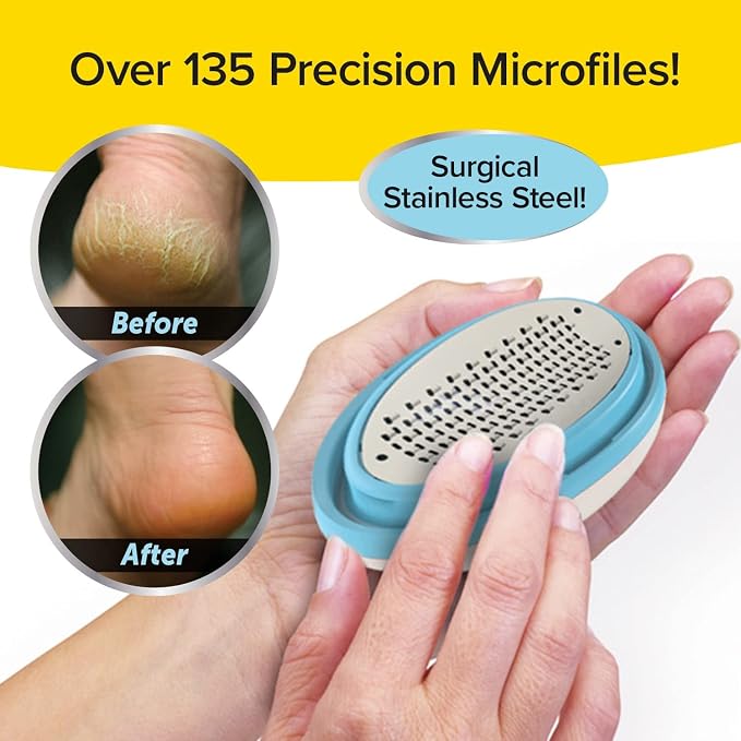 PedEgg Foot File – Traps Shavings Inside - Image 4