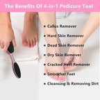 Foot File Callus Remover 4-in-1, Feet Scraper Pedicure Tools - Image 4