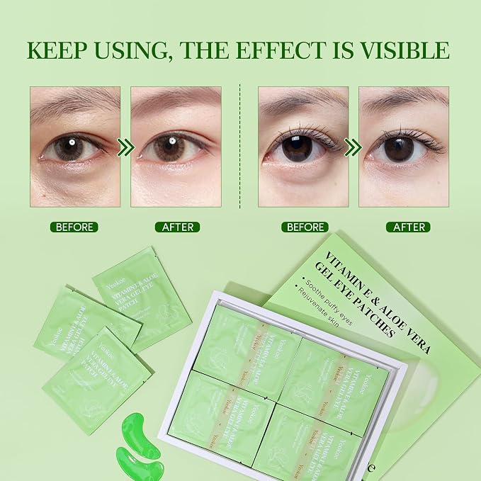 Yeokoe Under Eye Patches for Dark Circles, Puffy Eyes, 20 Pairs Face Masks - Image 4