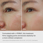 REJURAN® Ampoule Infused Lifting Mask, DOT™ c-PDRN® – Firming & Pore-Tightening - Image 4
