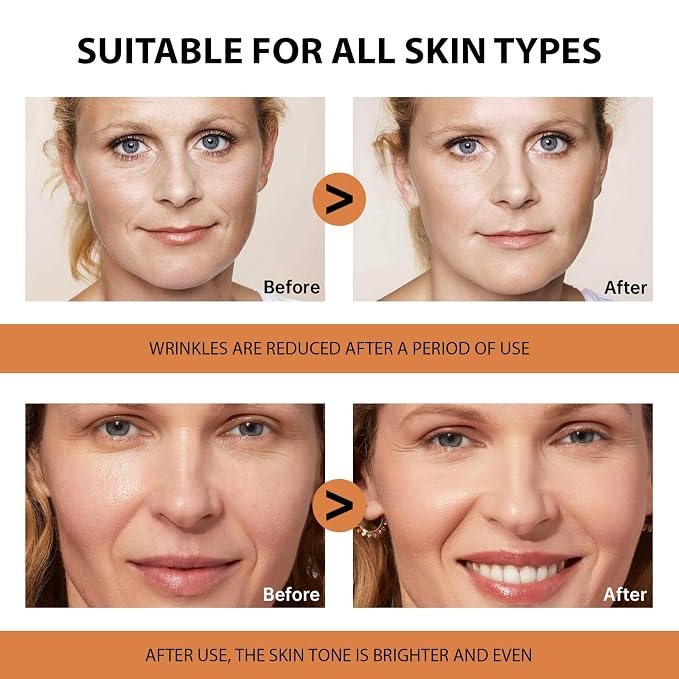 VGO Vitamin C Serum for Face, Vit C Anti Aging Serum - Image 6