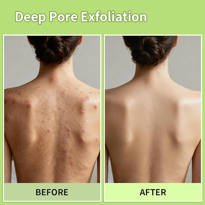 Korean Exfoliating Mitt & Glove Set, Smooth Skin and Spa-Like Experience - Image 5