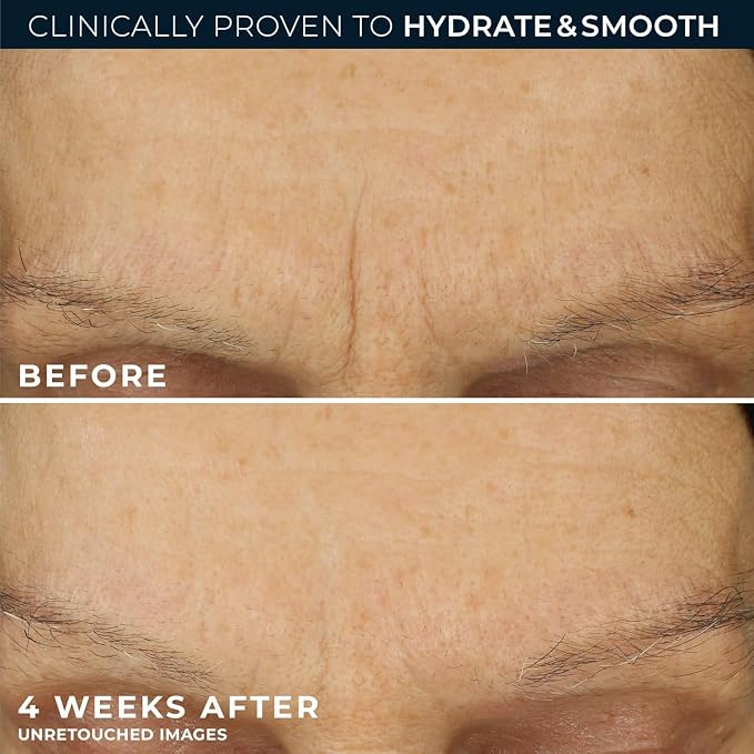RoC Retinol Correxion Max Hydration Anti-Aging Daily Face Moisturizer - Image 4