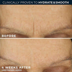 RoC Retinol Correxion Max Hydration Anti-Aging Daily Face Moisturizer - Image 4