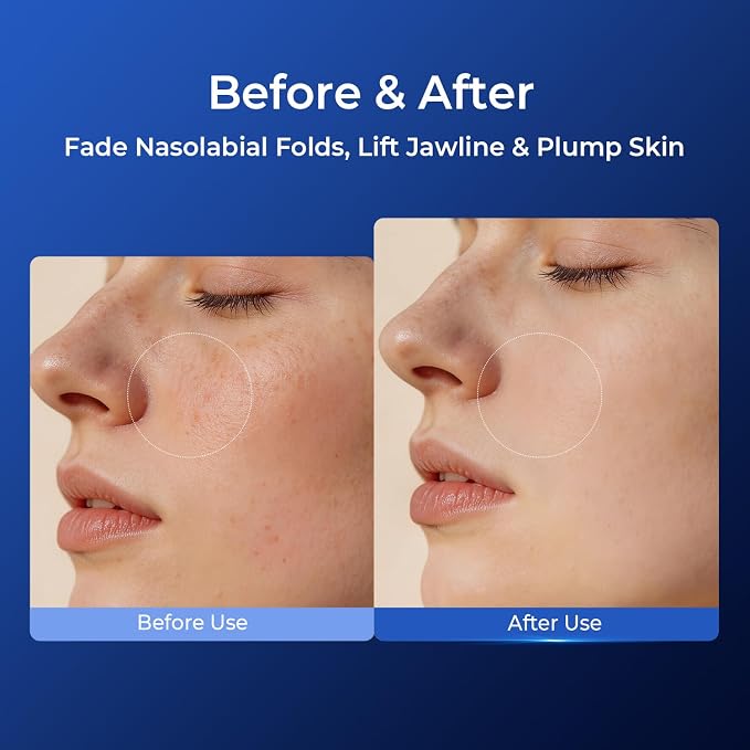 Multi-Molecular Hyaluronic Acid Toner, Hydrating Facial Toner - Image 6