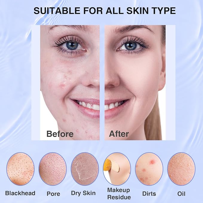 Silicone Face Scrubber, Waterproof Electric Facial Cleansing Brush - Image 6