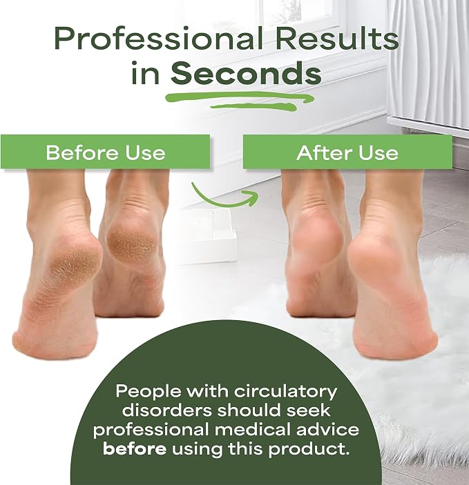 Pumice Stone for feet Extra Large Foot File & Callus Remover for Cracked Heels - Image 5