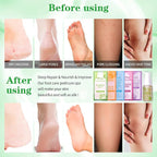 Pedicure Foot Soak Set - Image 3