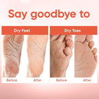 CÉLOR Foot Peeling Mask for Dry Cracked Feet | Foot Mask to Exfoliate Rough - Image 4