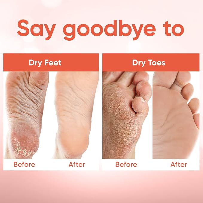 CÉLOR Foot Peeling Mask for Dry Cracked Feet | Foot Mask to Exfoliate Rough - Image 4