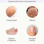 Epielle Relaxing & Nourishing Hand & Foot Masks, Soften Dry, Overworked Skin - Image 4
