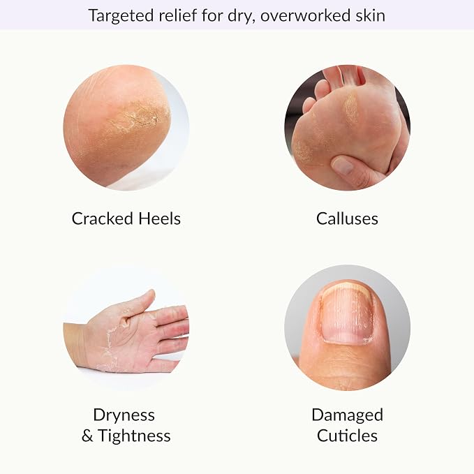 Epielle Relaxing & Nourishing Hand & Foot Masks, Soften Dry, Overworked Skin - Image 4