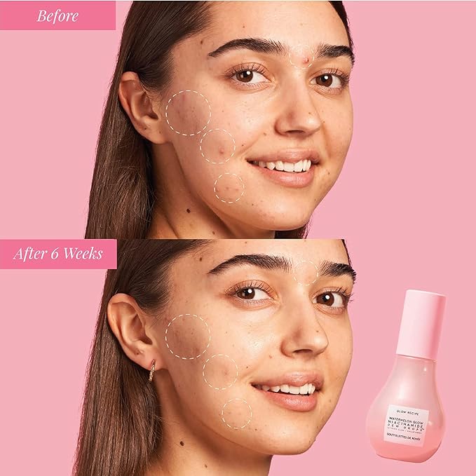Glow Recipe Watermelon Niacinamide Dew Drops, Korean Niacinamide Serum Drops - Image 7
