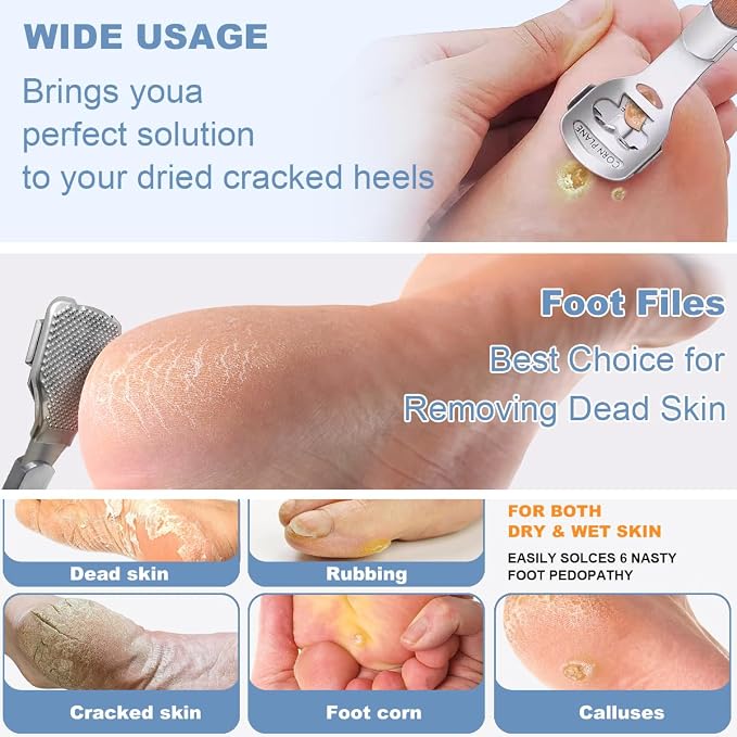 36 Pcs Callus Shaver for Feet Set, Foot Callus Shaver - Image 4