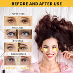 24K Gold Eye Masks for Dark Circles and Puffiness 70PCS, Under Eye Patches for - Image 6