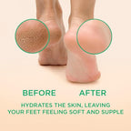 Lee Beauty Professional Callus Remover - Image 2
