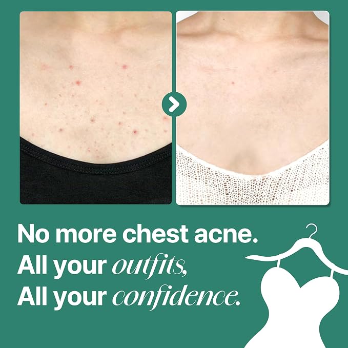 SOME BY MI AHA BHA PHA 30 Days Miracle Acne Clear Body Cleanser – Pack of 2 – - Image 5