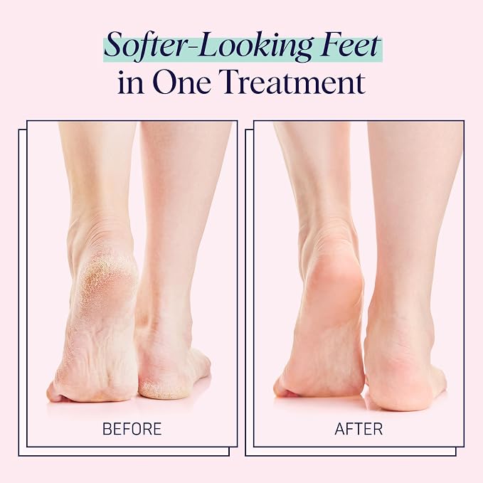 SpaLife Moisturizing Foot Sockies | Mothers Day Gifts & Foot Mask - Image 6