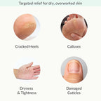 Epielle Relaxing & Nourishing Hand & Foot Masks, Soften Dry, Overworked Skin - Image 4