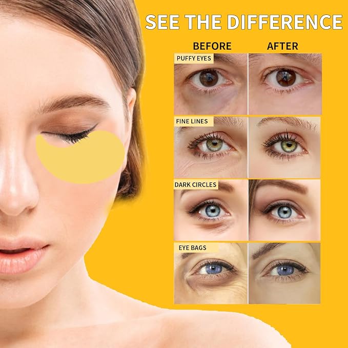 24K Gold Eye Masks for Dark Circles and Puffiness 70PCS, Under Eye Patches for - Image 4