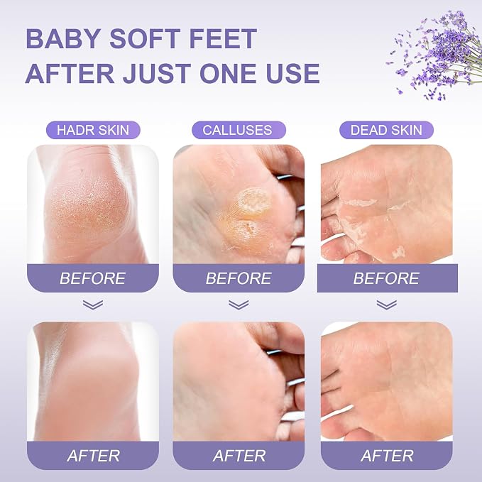 Foot Peeling Mask Exfoliant for Peeling Off Calluses, Natural Exfoliator for - Image 4