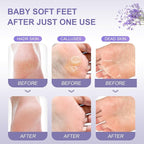 Foot Peeling Mask Exfoliant for Peeling Off Calluses, Natural Exfoliator for - Image 4