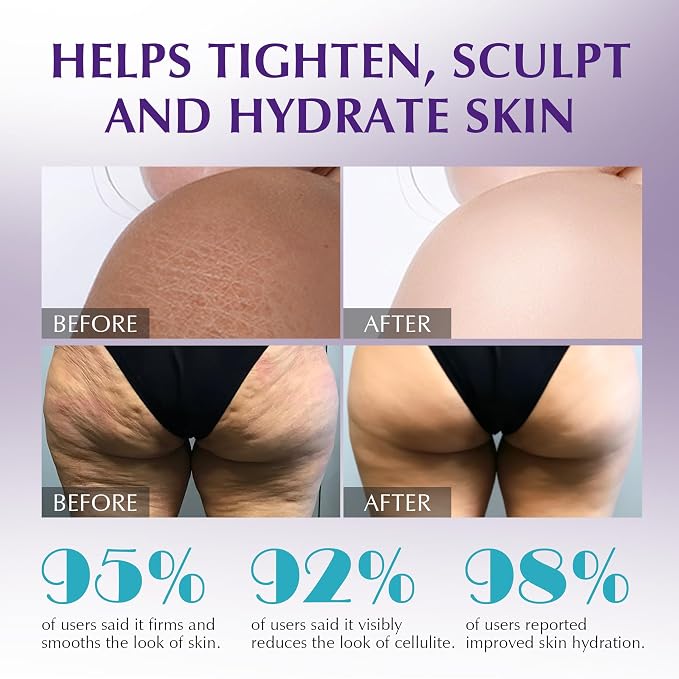 Anti Cellulite Massage Oil for Massage Therapy - Image 5