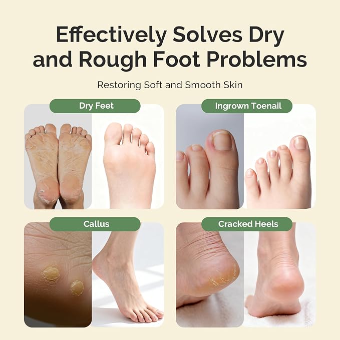 MelodySusie Tea Tree Oil Foot Soak - Image 2