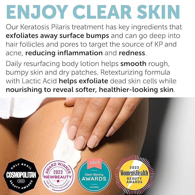 Keratosis Pilaris Treatment | Keratosis Pilaris Lotion - Image 5