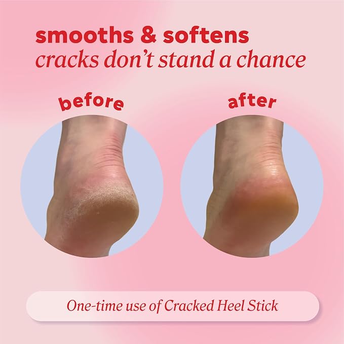 Onyx Professional Cracked Heel Repair Balm Stick - Image 4