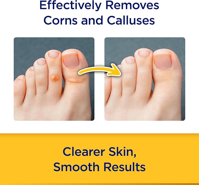CornStick Maximum Strength Salicylic Acid Solid-Stick Corn and Callus Remover - Image 3