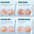 Blackhead Remover Tool Kit, Skin Scraper - Image 2
