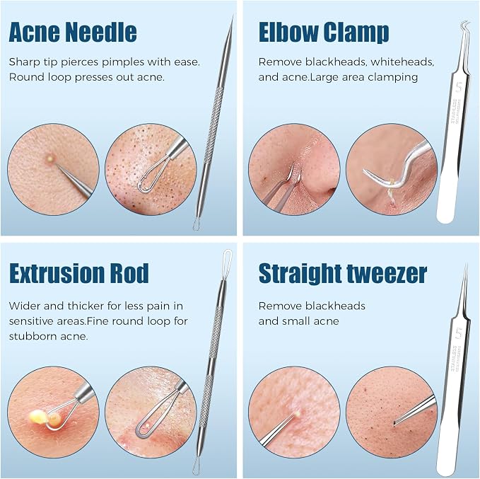 Blackhead Remover Tool Kit, Skin Scraper - Image 2