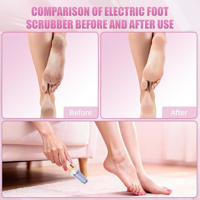 Pedicure Tool, Foot Callus Remover, Electric Pedicure Set, Foot Care, Removes - Image 5