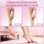 Pedicure Tool, Foot Callus Remover, Electric Pedicure Set, Foot Care, Removes - Image 5