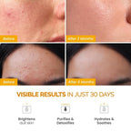 PLANTIFIQUE Korean Turmeric Clay Mask - Image 2