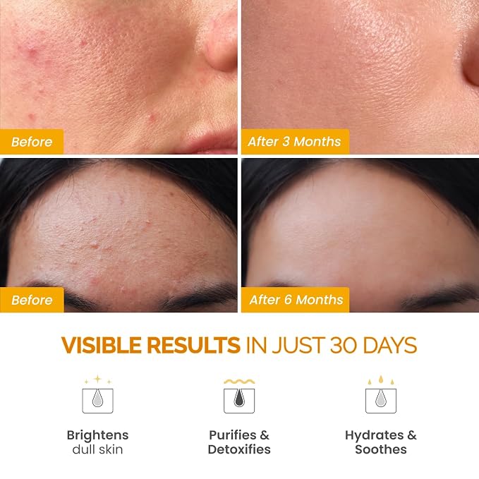 PLANTIFIQUE Korean Turmeric Clay Mask - Image 2