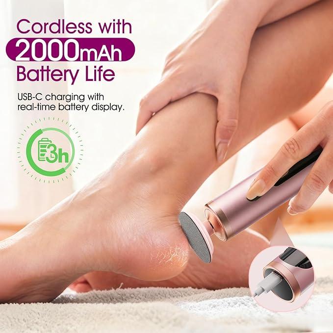 Electric Foot Callus Remover for Dry Foot Skin, Electric Foot File - Image 5