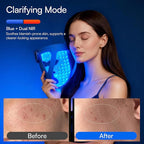 INIA Glow 4D Wireless Red Light Therapy Mask - Image 5